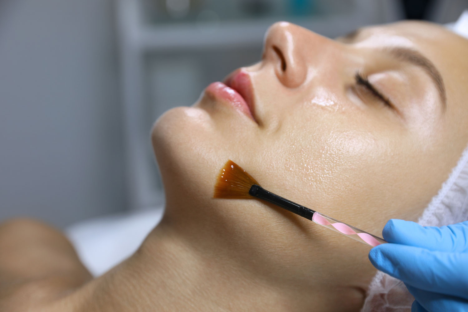 Provider performing a chemical peel